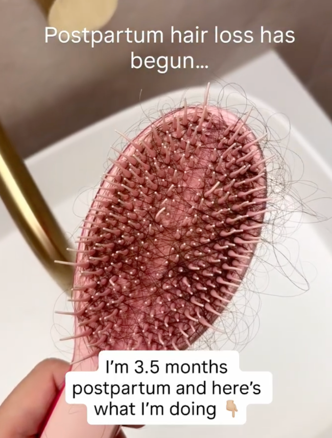 Postpartum Hair Loss