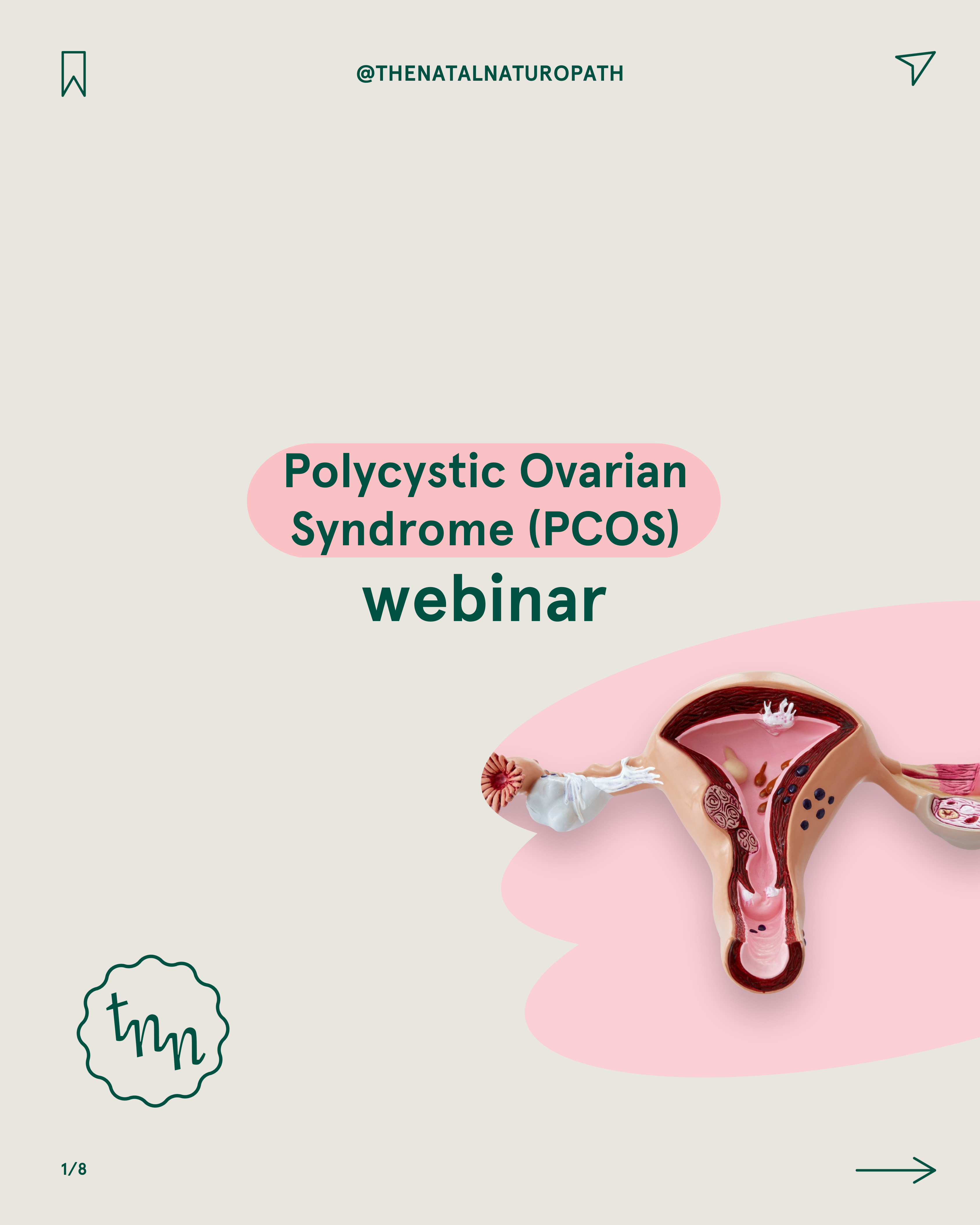 Promotional graphic for a webinar on Polycystic Ovarian Syndrome (PCOS) by Naternal Vitamins, featuring a detailed anatomical illustration of the female reproductive system on a light beige background with soft pink accents. The design is clean and informative, aimed at educating viewers on PCOS.